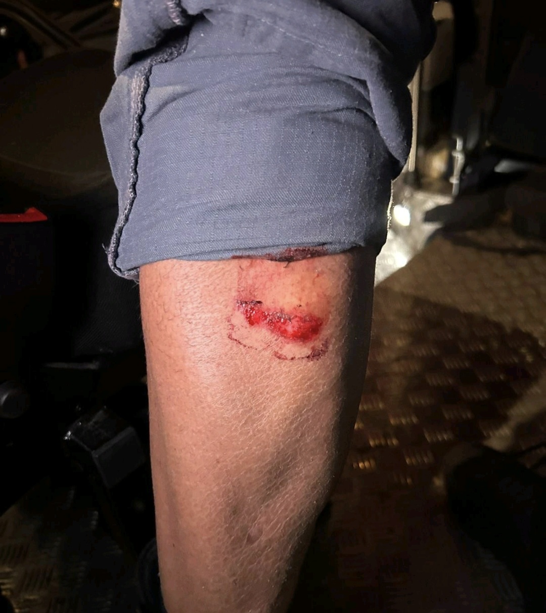 Manifestazione agente ferito1