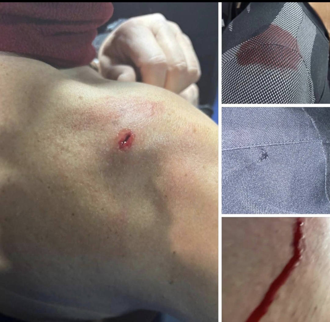 Violenza dei bolognesi